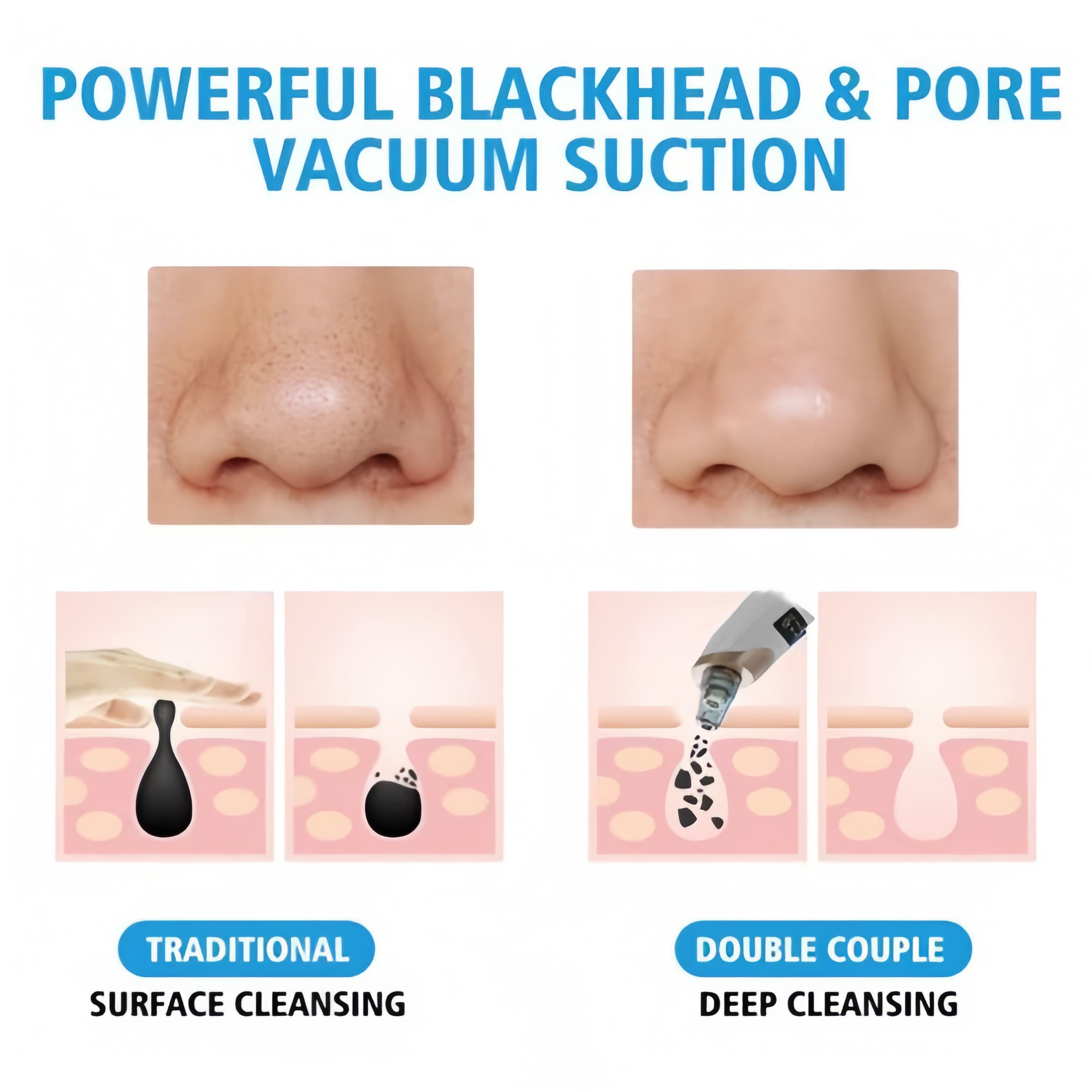 Electric Suction Blackhead Pore Cleaning Machine