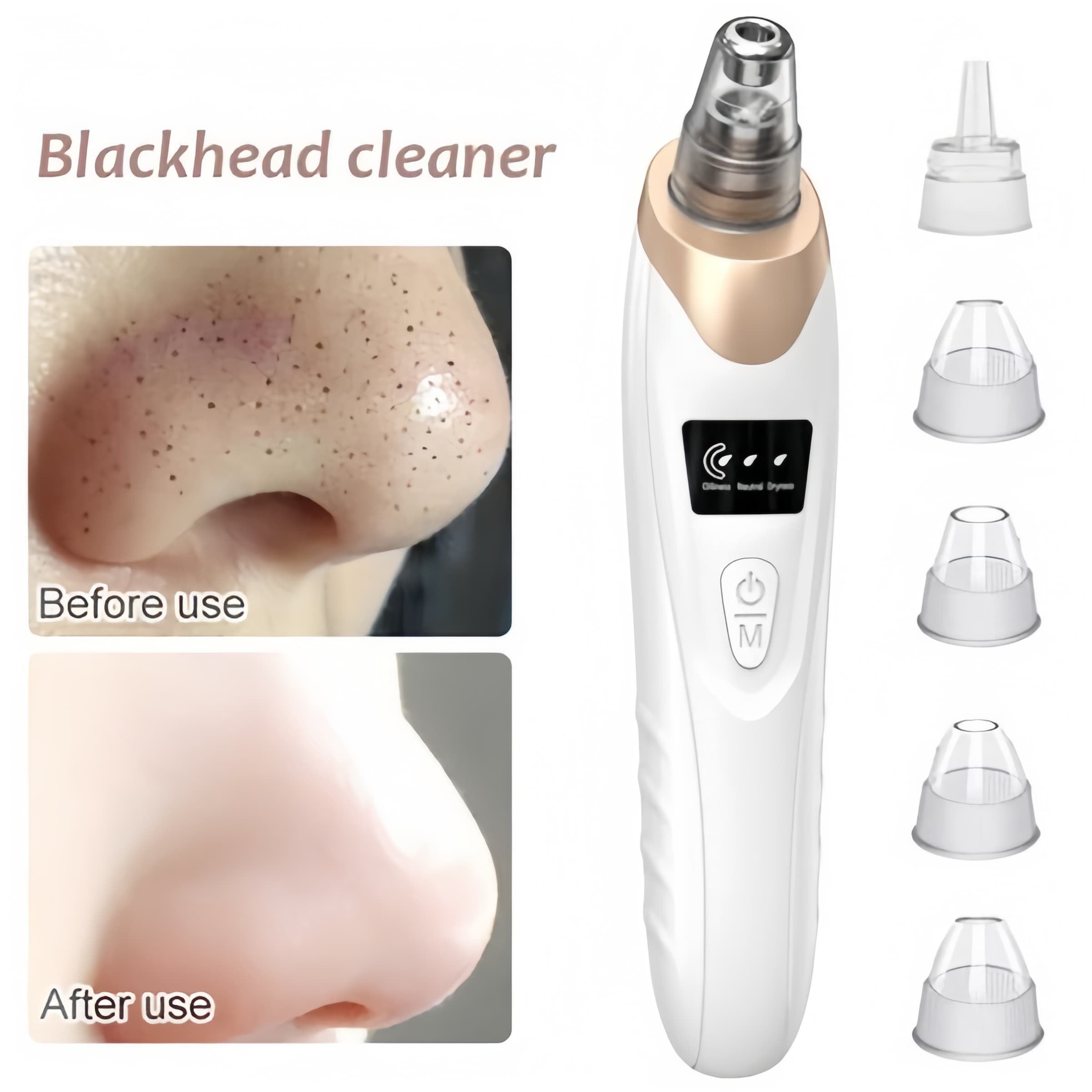 Electric Suction Blackhead Pore Cleaning Machine