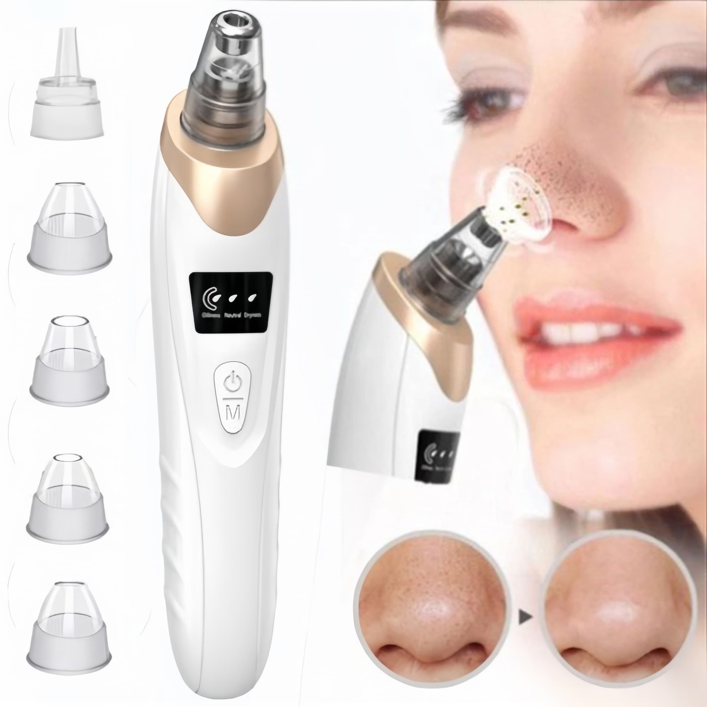 Electric Suction Blackhead Pore Cleaning Machine